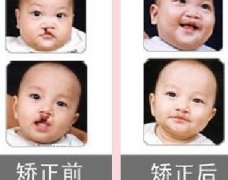 吃兔肉真的會長兔唇？為什么會長兔唇？